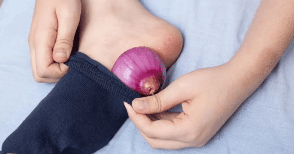cebolla en los pies
