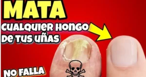 vinagre para hongos